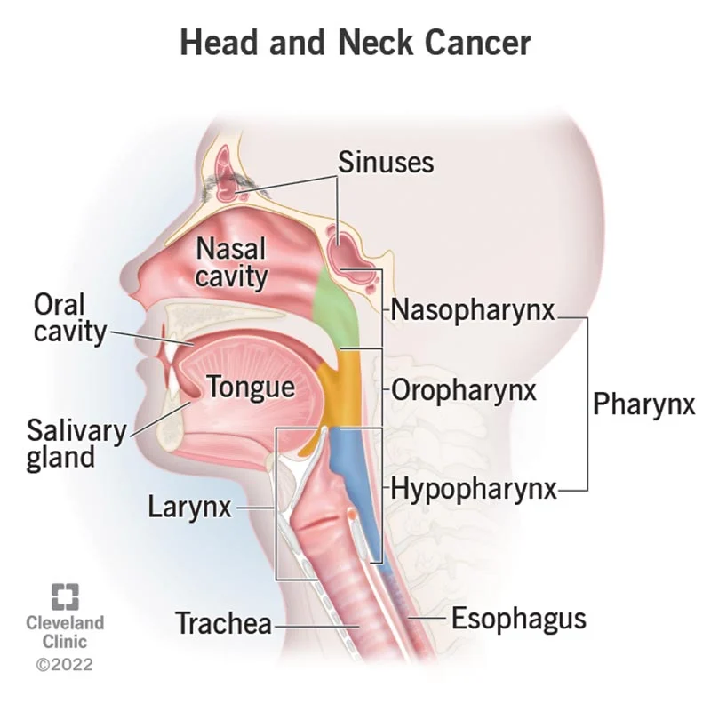 head-neck-cancer-treatment-in-aurangabad-marathwada-cancer-hospital